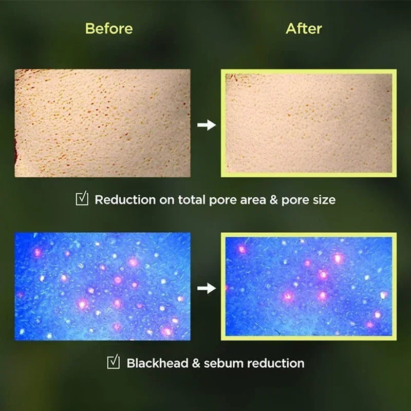 Korean Heartleaf Anti-Aging Skincare Set