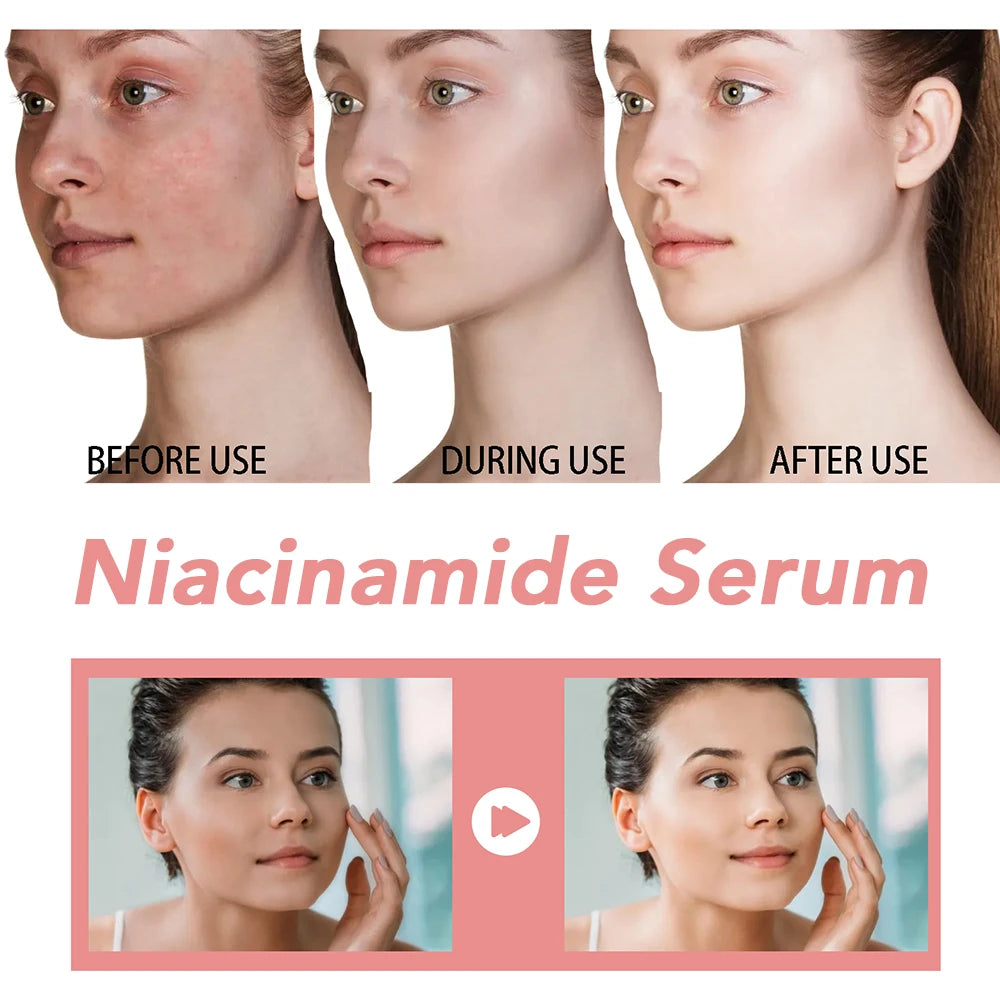 30ml Niacinamide Dark Spot Corrector Serum