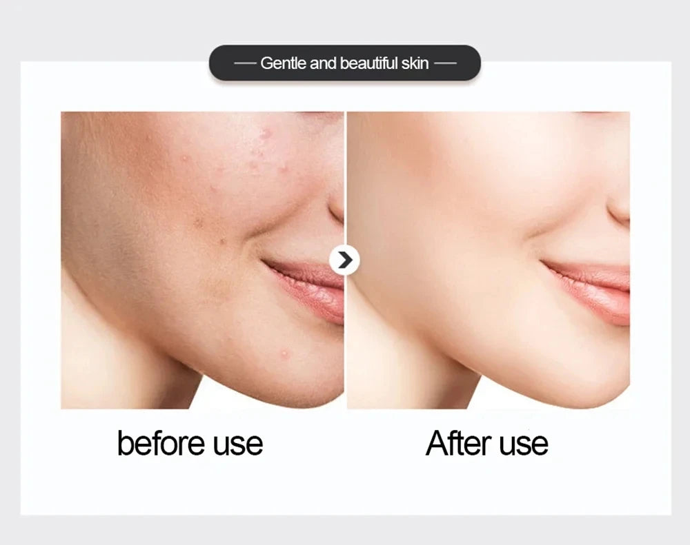 500ml Niacinamide Essence Toner